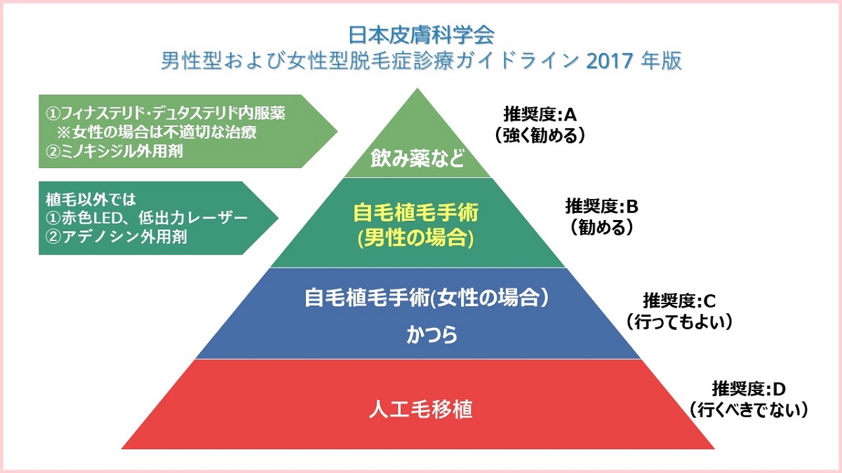 拒絶反応や後遺症の心配がない自毛植毛の仕組み