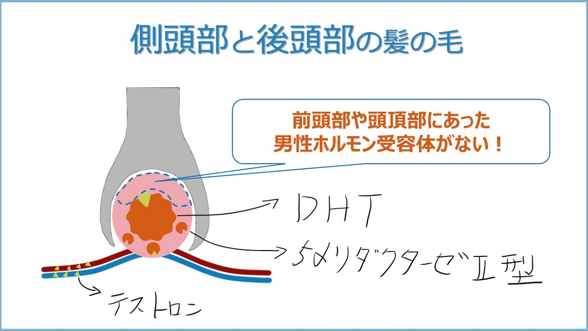 手術した後は半永久的に生え続ける自毛植毛の仕組み