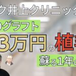 アスク井上クリニック自毛植毛体験談