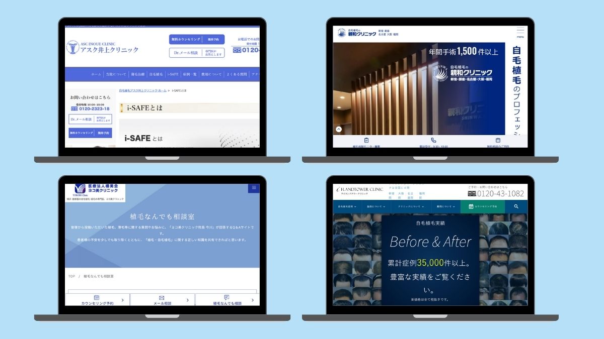失敗しないポイントで自毛植毛クリニックを比較