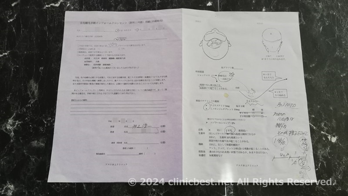 アスク井上クリニック自毛植毛体験談 手術当日 インフォームドコンセント