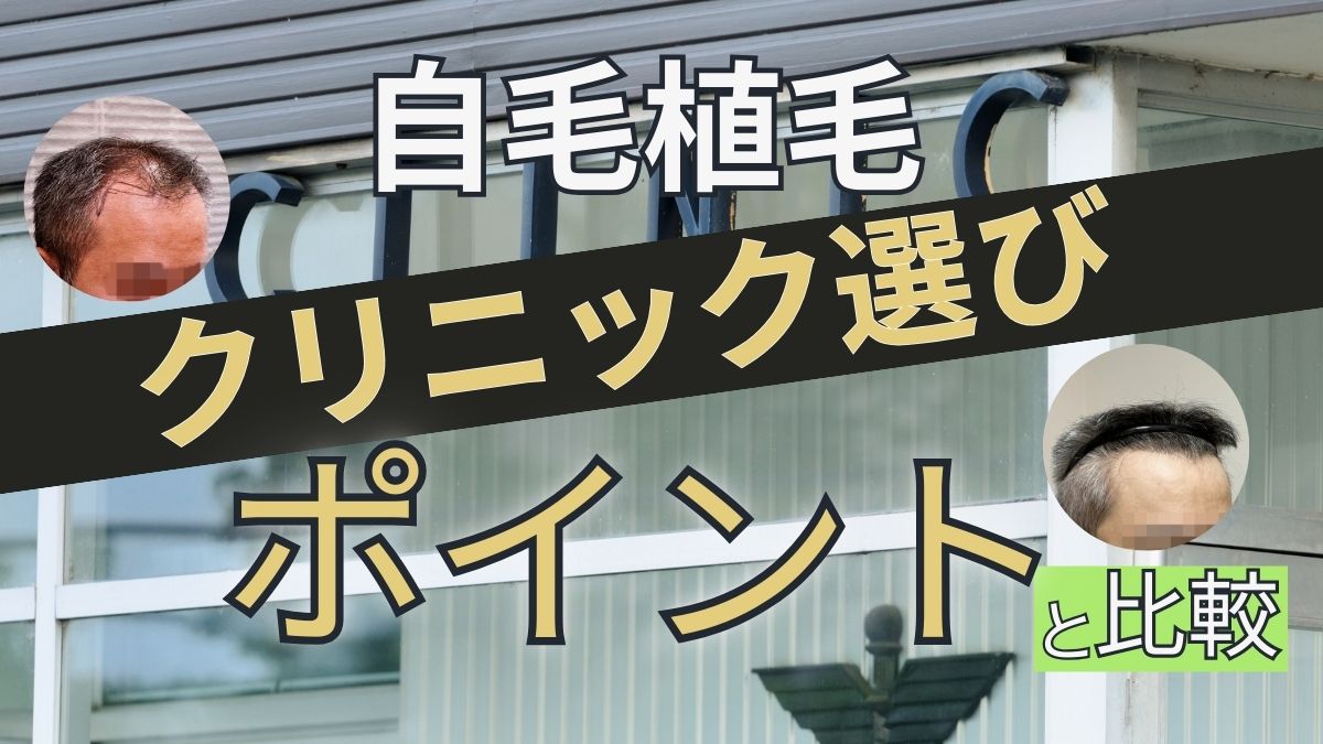 自毛植毛クリニック選び方おすすめクリニック比較